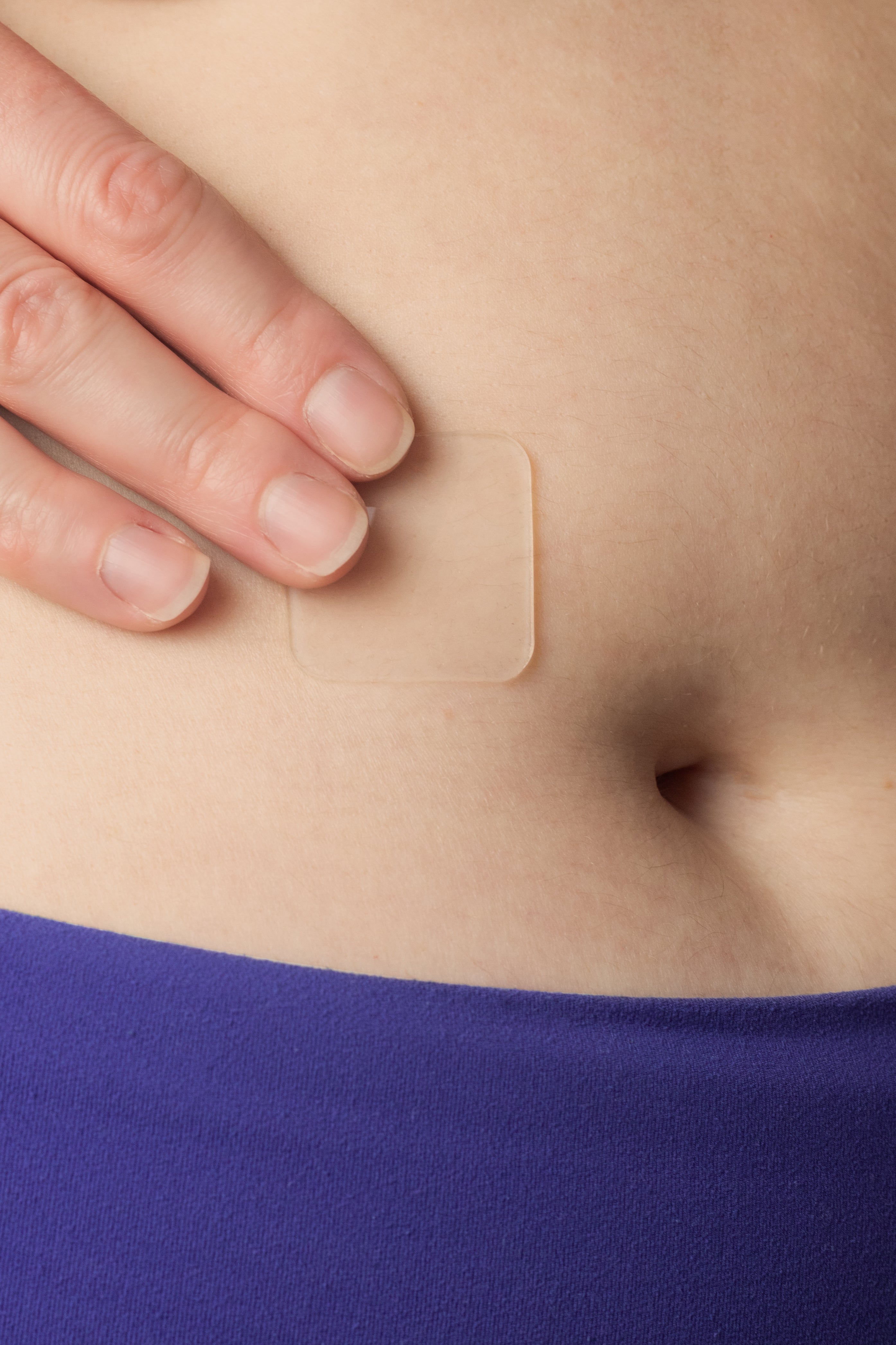 Silicone scar gel for laparoscopic surgery scars