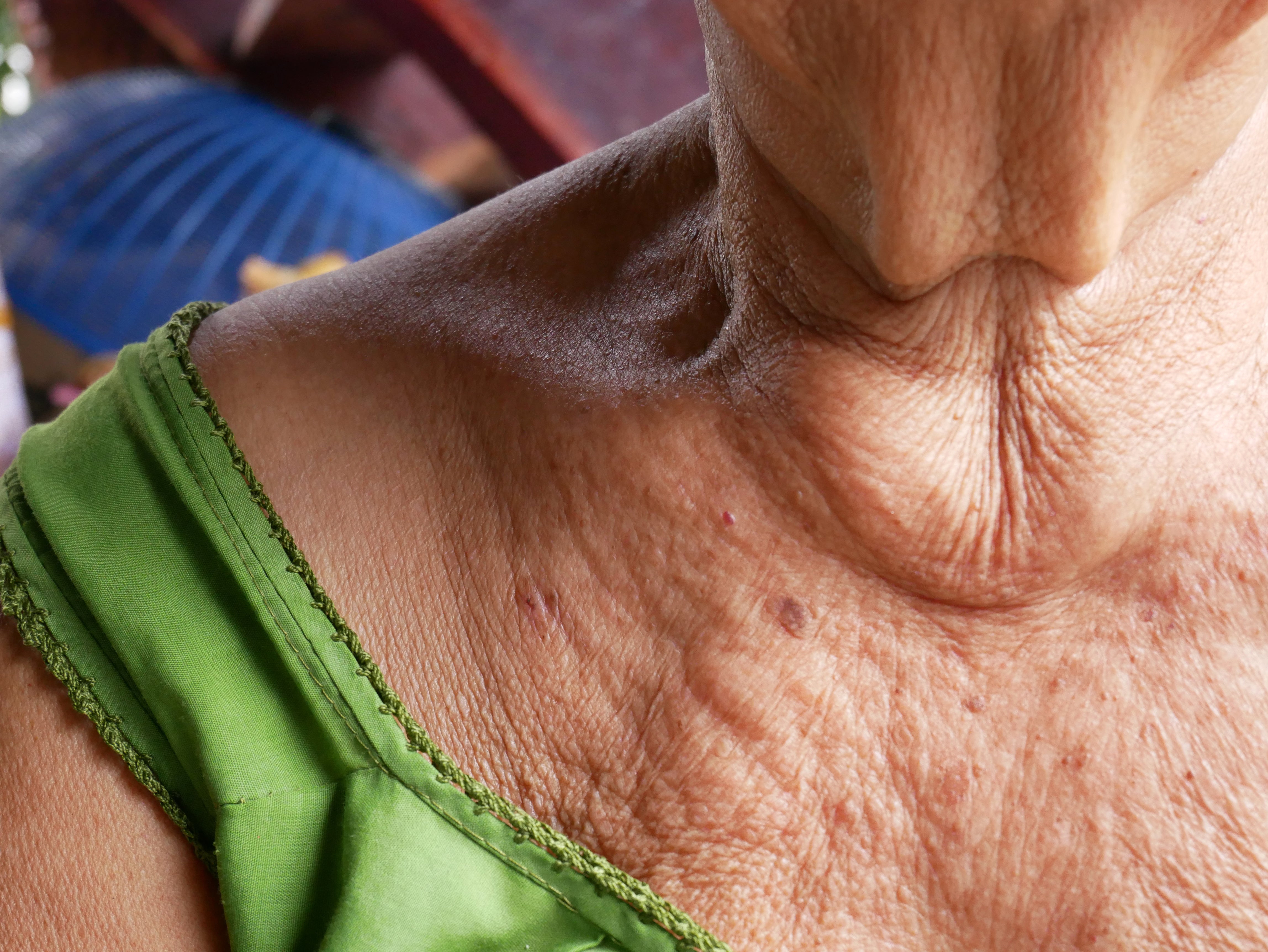 Why Does Skin Sag? How Our Advanced Firming Cream Can Help