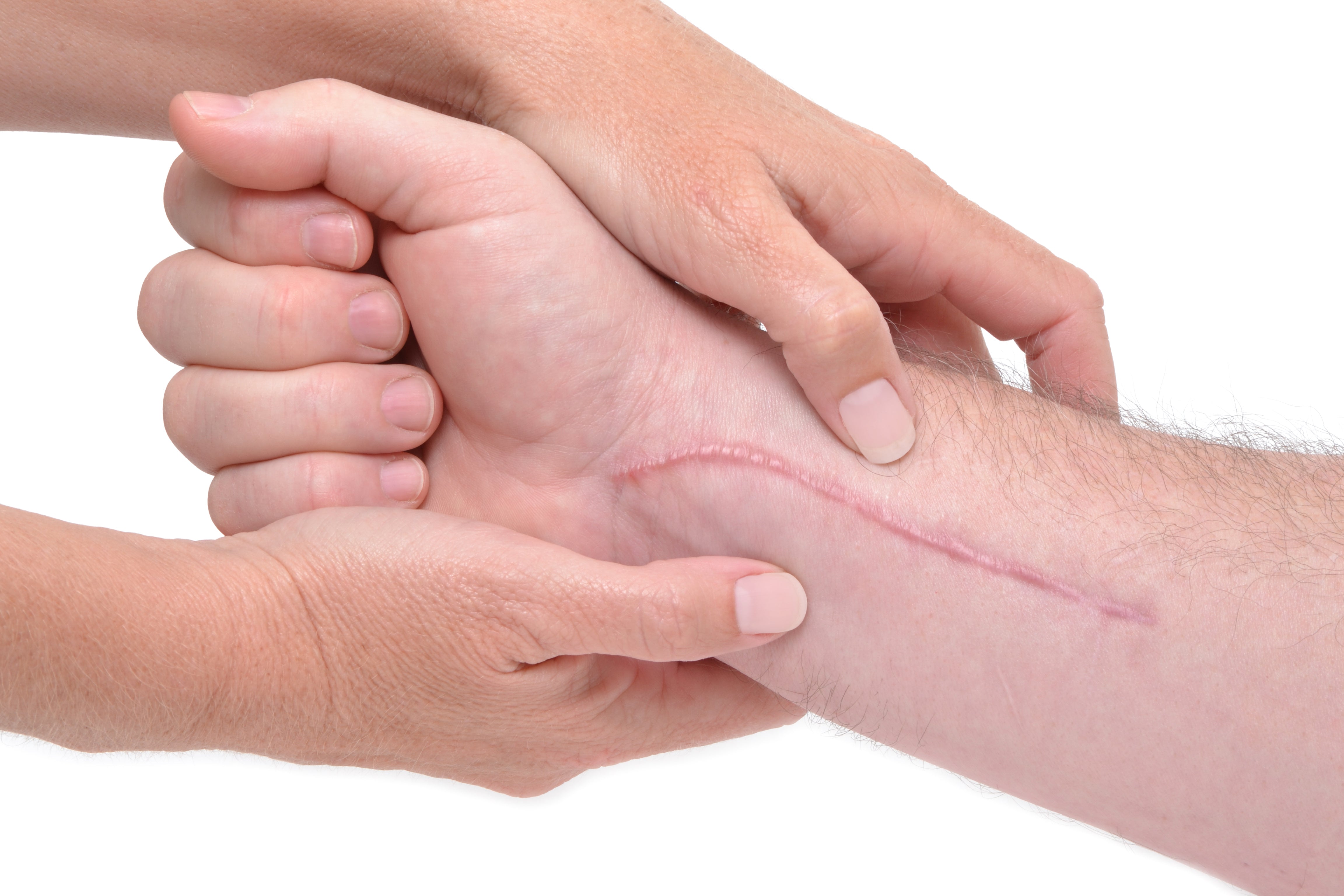 Product Spotlight: Medical-Grade Silicone Scar Sheeting