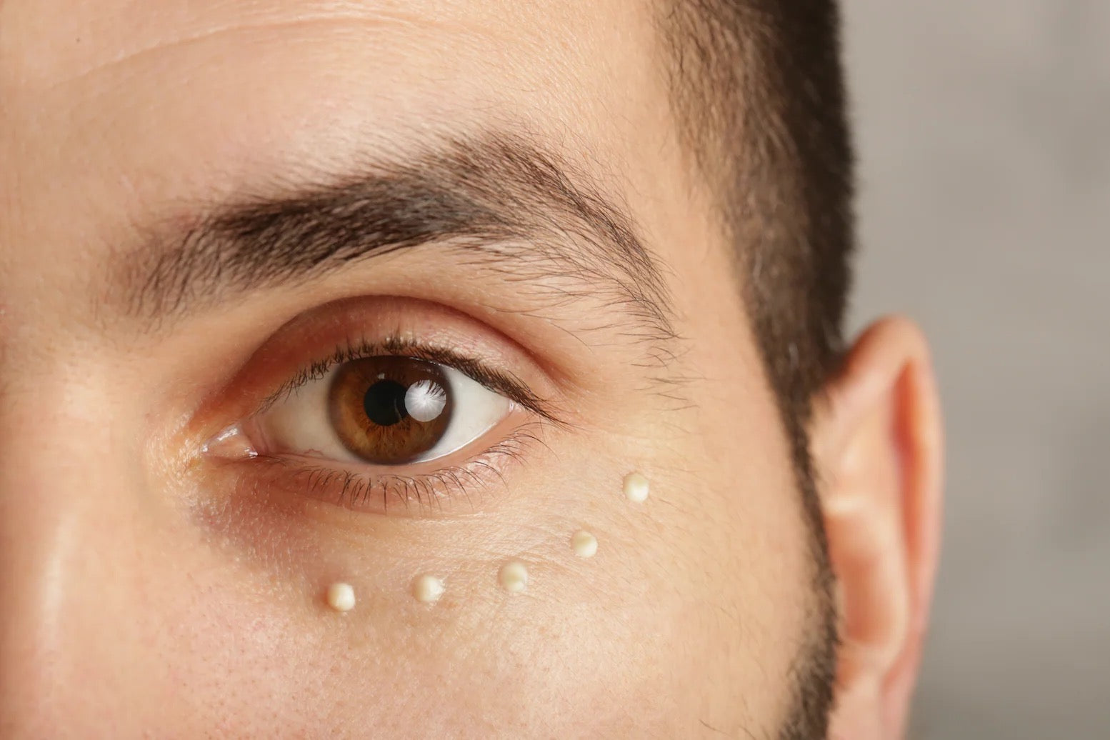 Do You Need Eye Cream? Benefits, Myths, and When to Use It