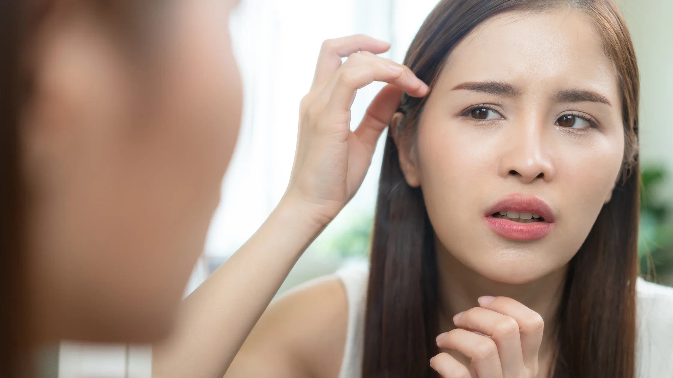 What Are Gentle Care Tips and Soothing Solutions for Facial Eczema?