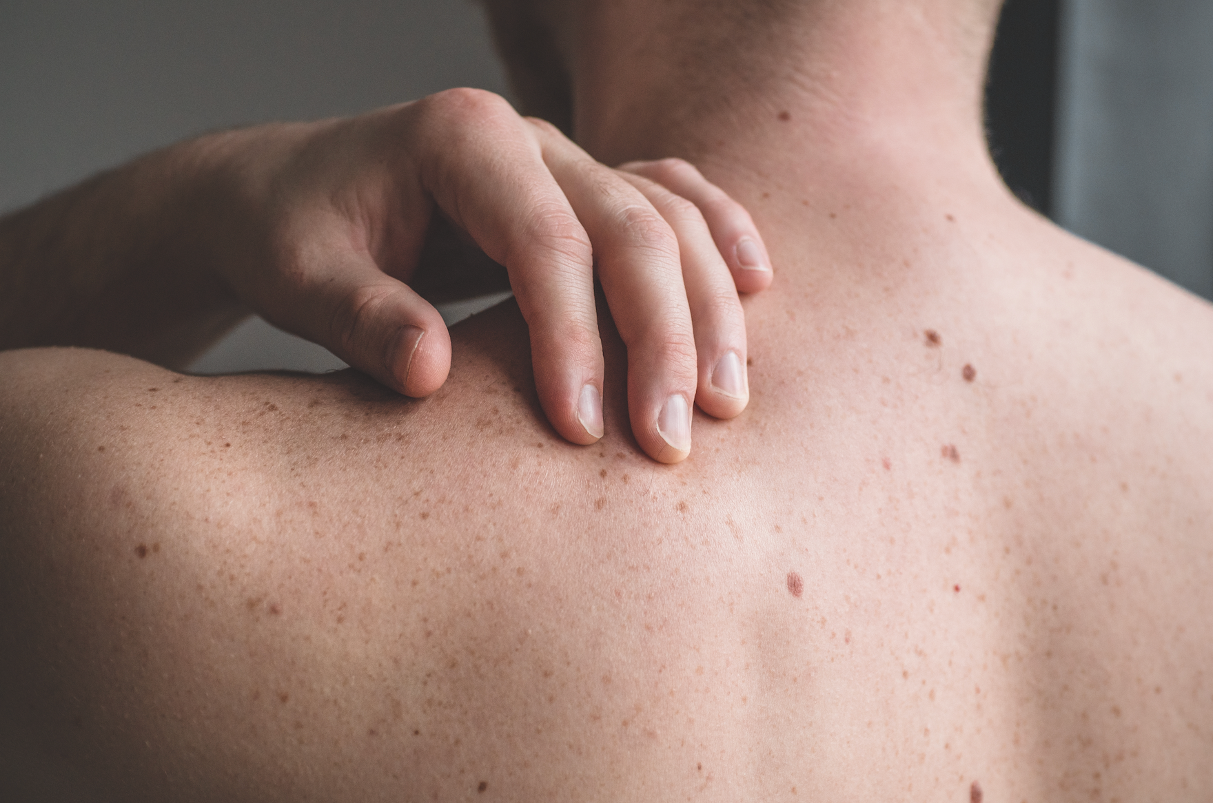 Why Are Men More Likely To Get Skin Cancer?