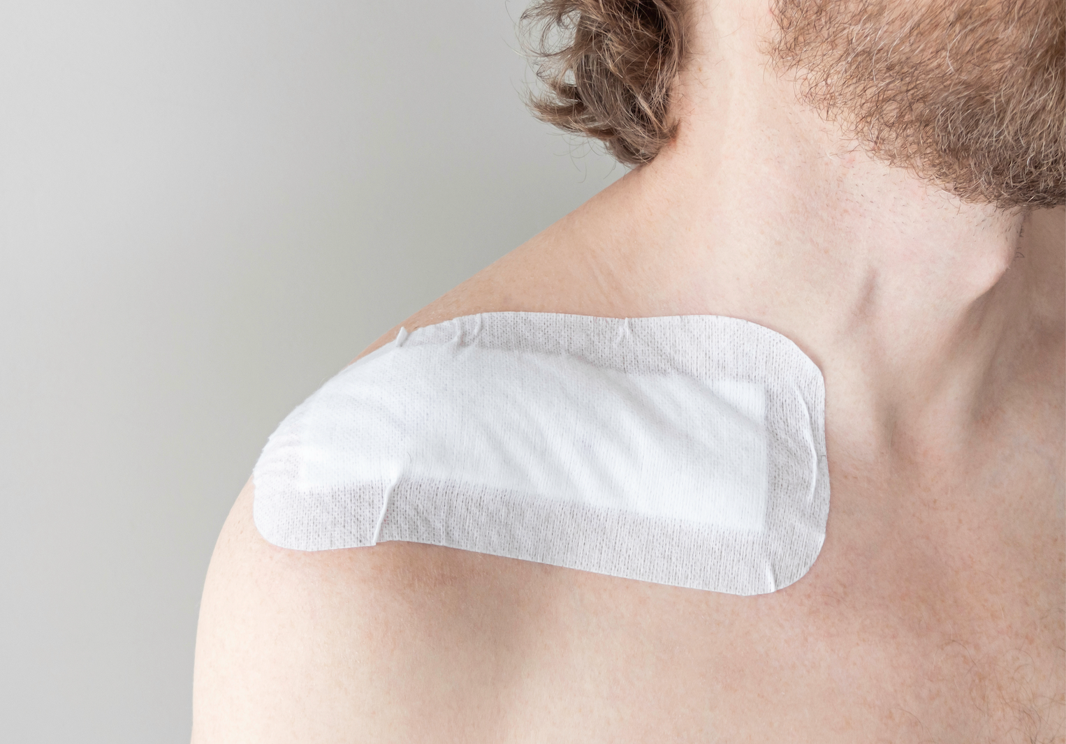 What Is Scar Revision Surgery? | how to get rid of scars, how long is recovery from scar revision surgery, scar removal surgery aftercare