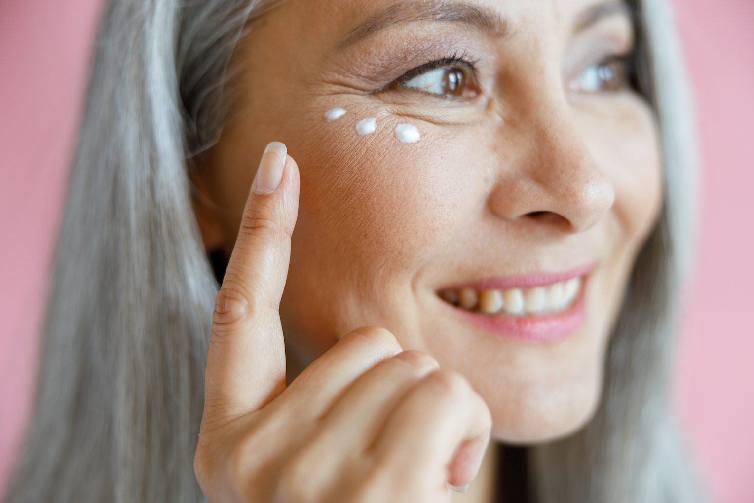 What Causes Dark Circles? (And How To Treat Each Cause) | dark circles treatment, how to get rid of dark circles under eyes, are dark circles permanent
