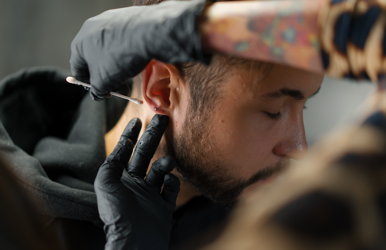 Keloids & Piercings: Why Does Getting Your Ears Pierced Cause Scarring? || how to get rid of piercing keloids, why do piercings cause keloids, piercing bump vs keloid