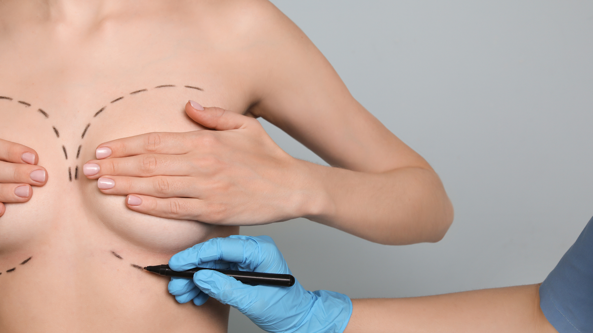 Best Scar Sheets for Breast Augmentation (2026 Guide)