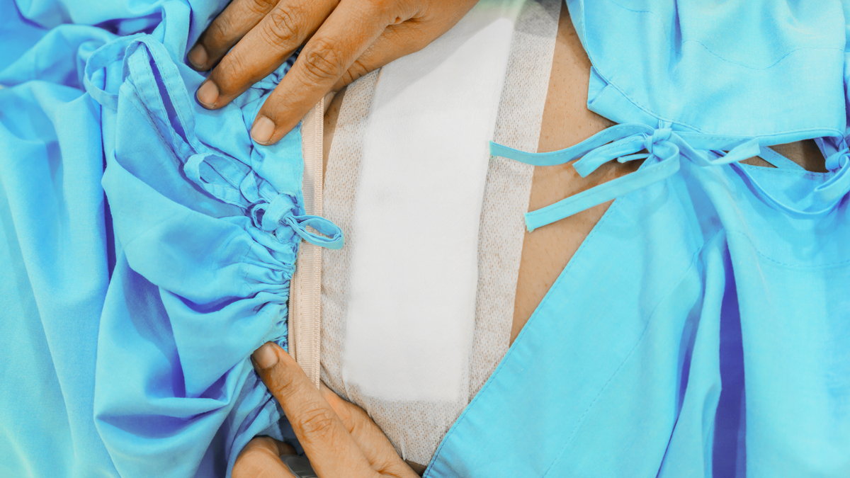 Silicone Sheets for Hysterectomy Scar: 2026 Buying Guide