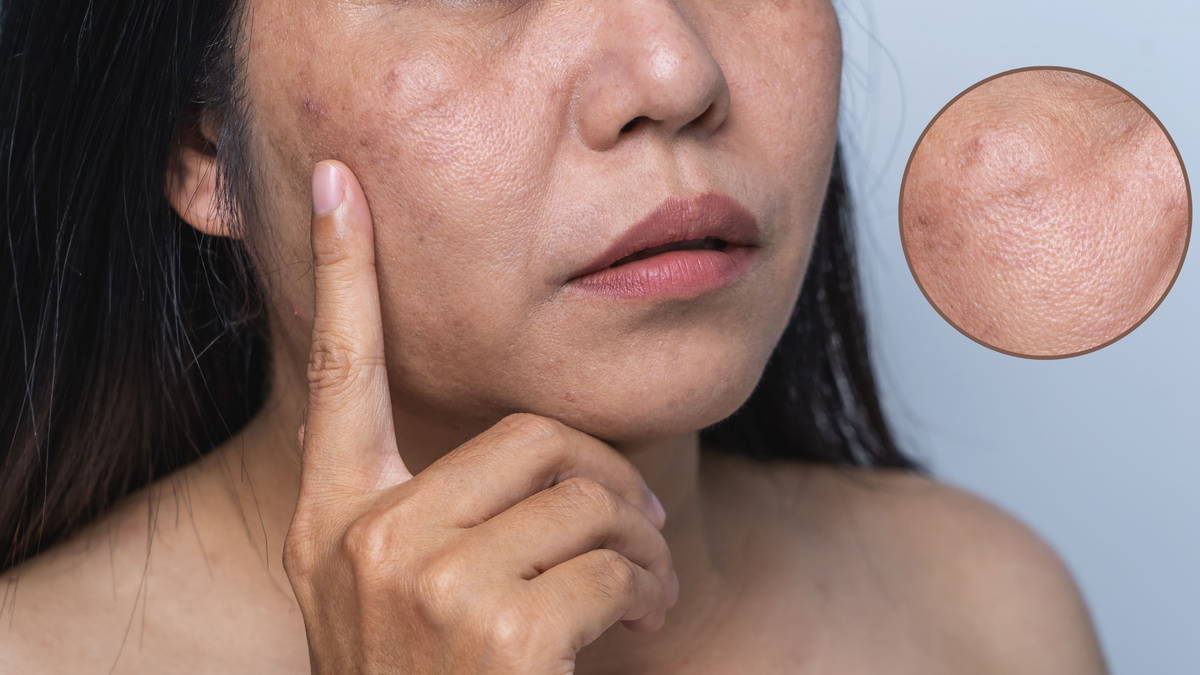 Best Facial Moisturizer for Combination Skin 2026