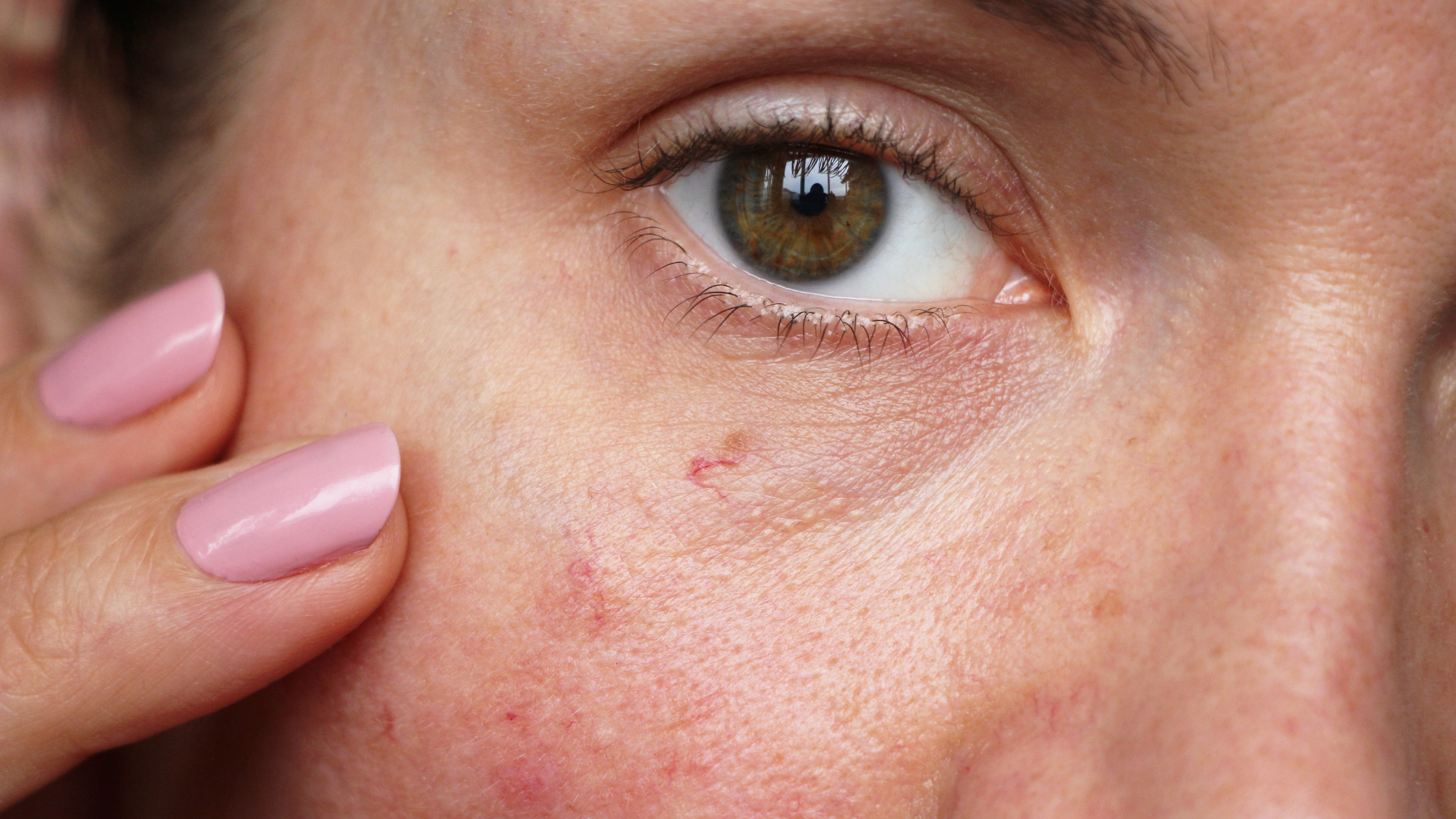 Best Scar Cream for Sensitive Skin (2026): Full Comparison