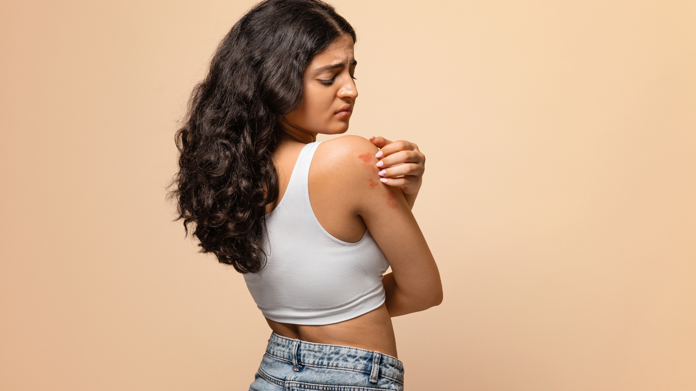 Eczema and Hormones: Why Flare-Ups Happen During Menstrual Cycles