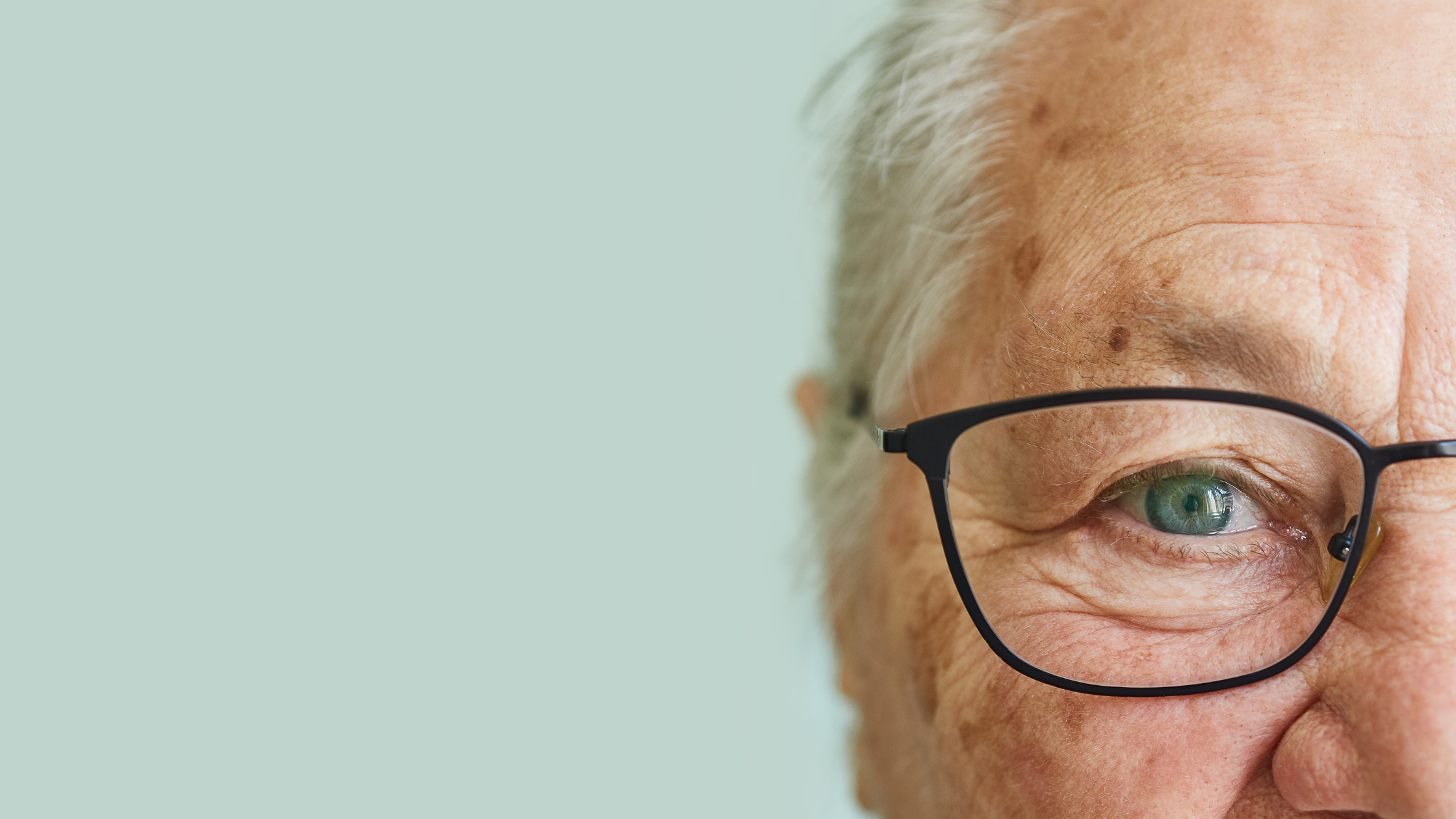 Blepharoplasty in Aging Skin: How Older Patients Heal Differently (and How to Protect Fragile Eyelid Scars)