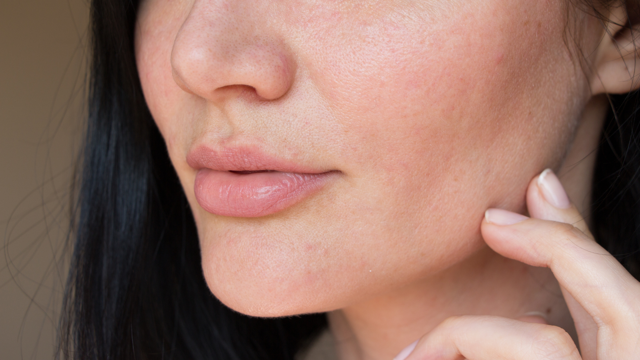 Skin Barrier Damage Isn’t Just Dry Skin: The Hidden Signs You’re Missing