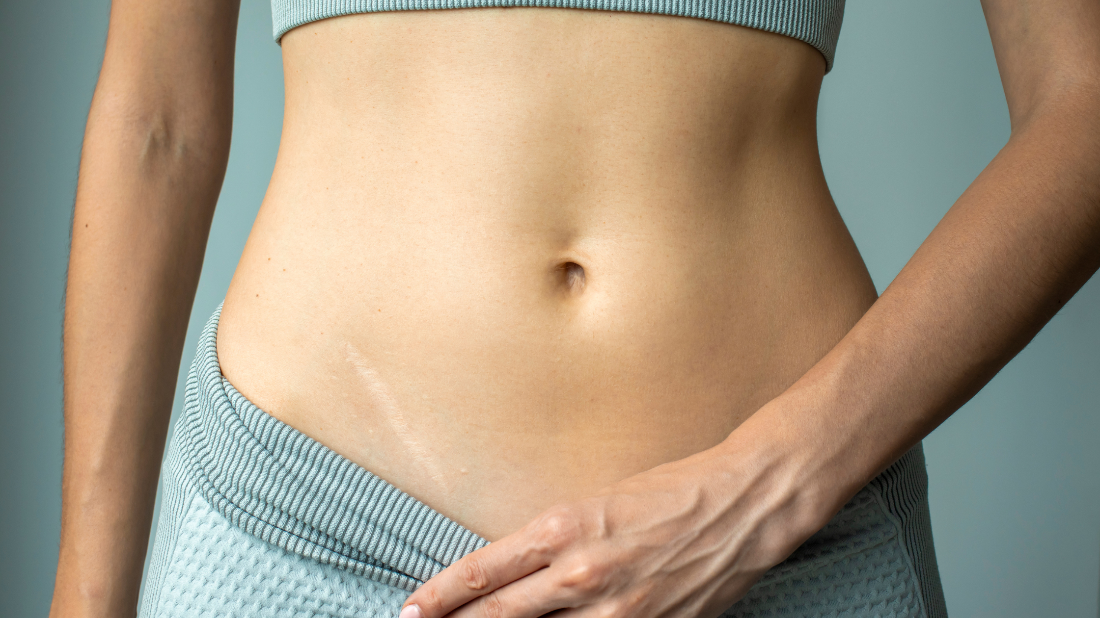 The Ultimate Guide to Scar Healing: From New Scars to Old Keloids