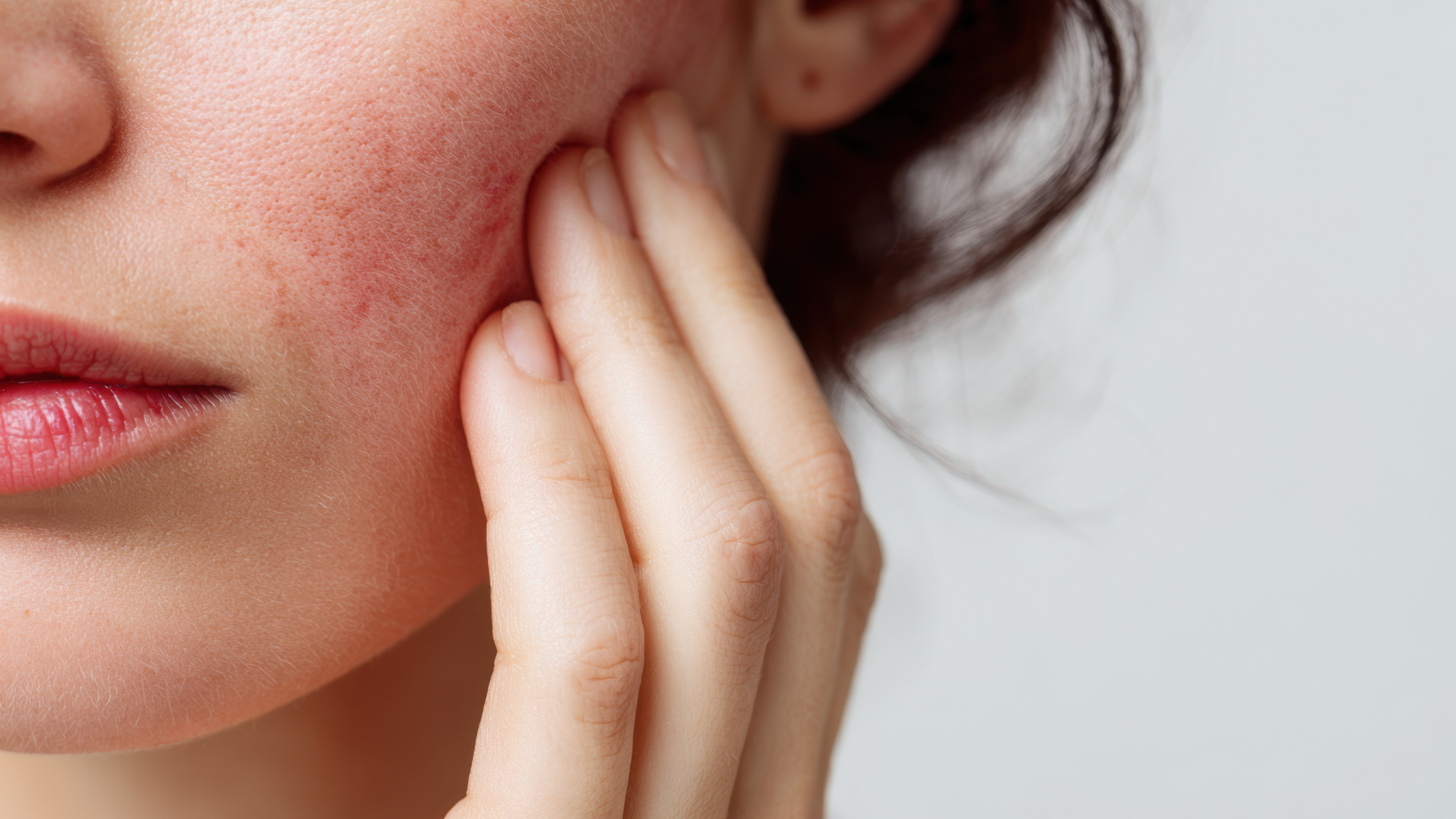 Common Skincare Ingredients That Can Irritate Compromised Skin
