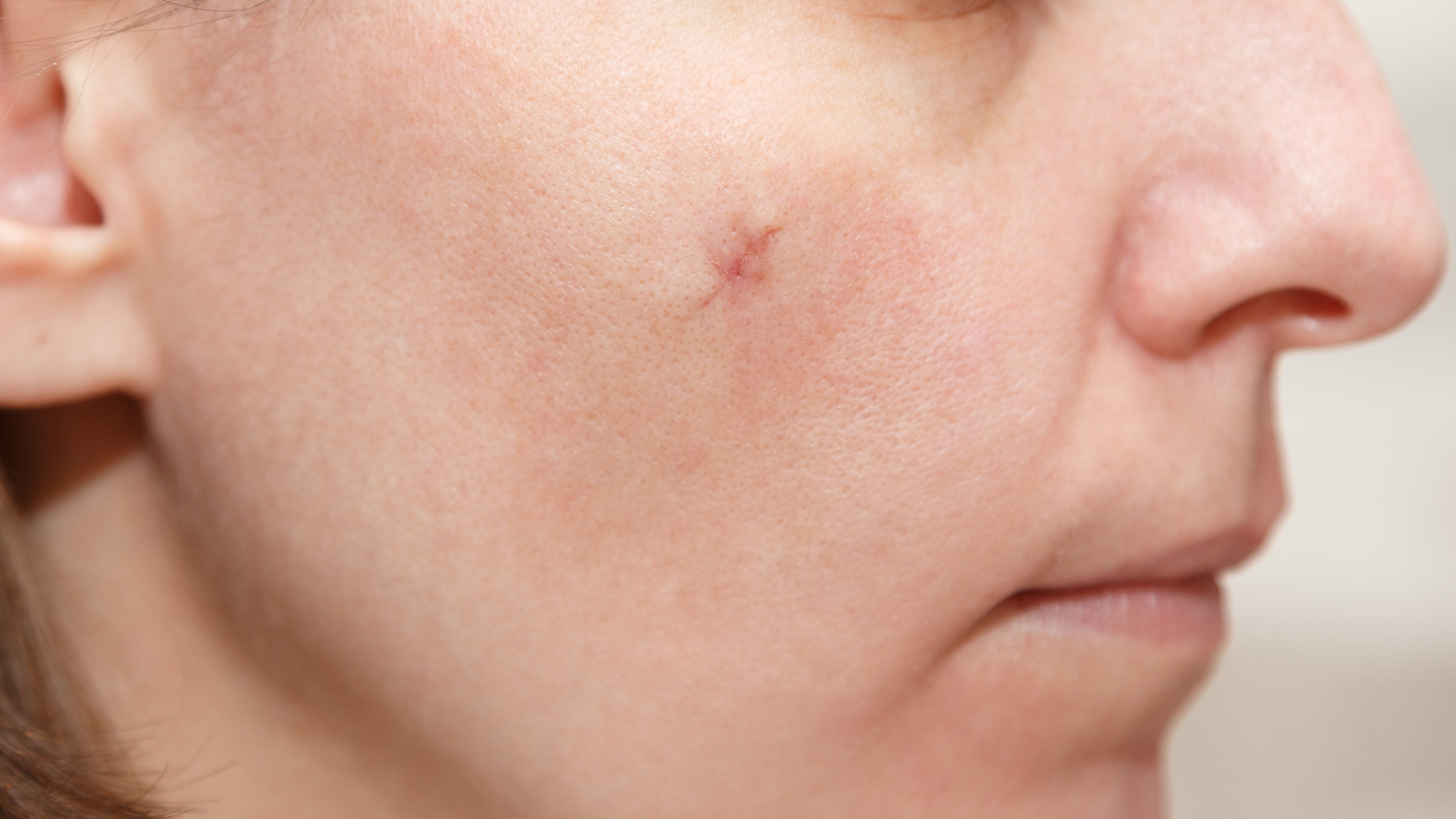 Can You Over-Treat a Scar? What Happens If You Use Too Many Products?