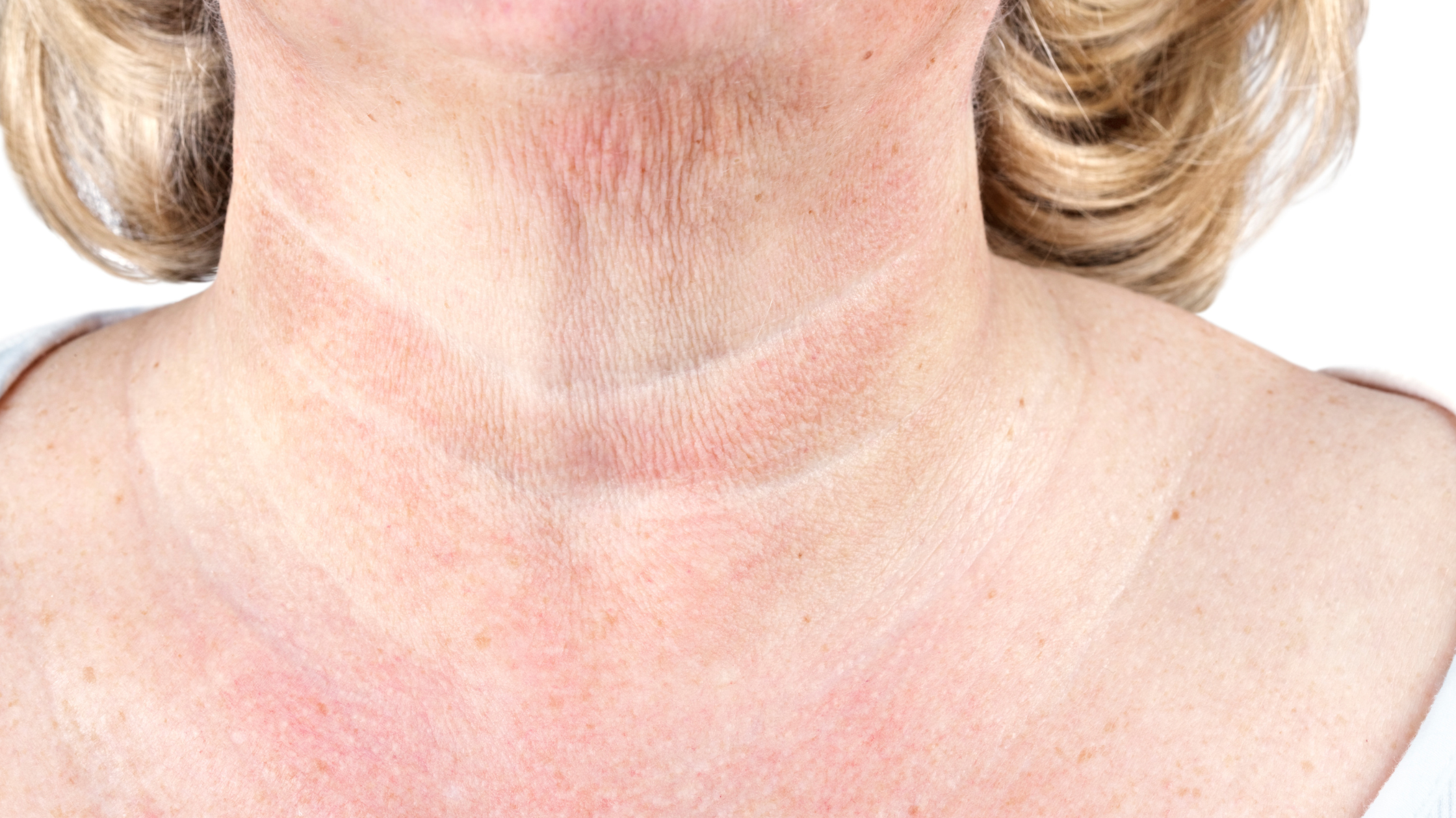 What Causes Crepey Skin and How Can You Improve It?