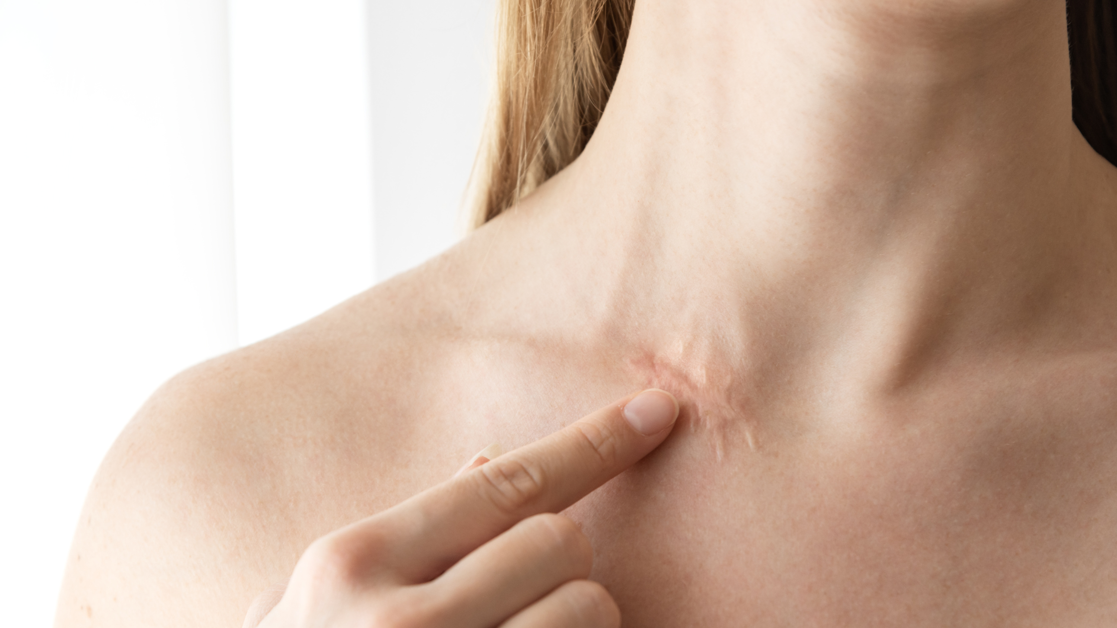 Can You Use Silicone Sheets and Gel at the Same Time?