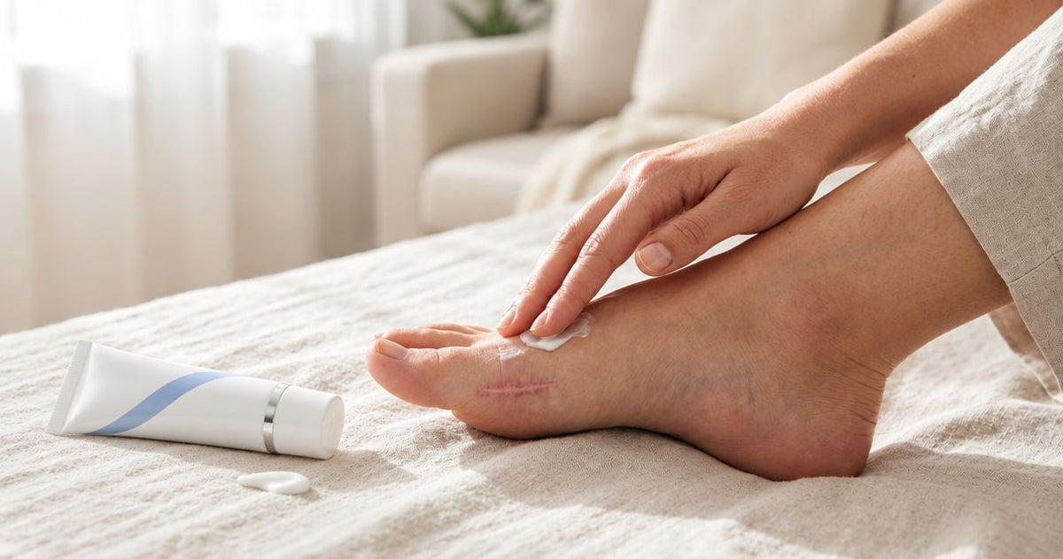 Scar cream for bunionectomy (bunion surgery) scars