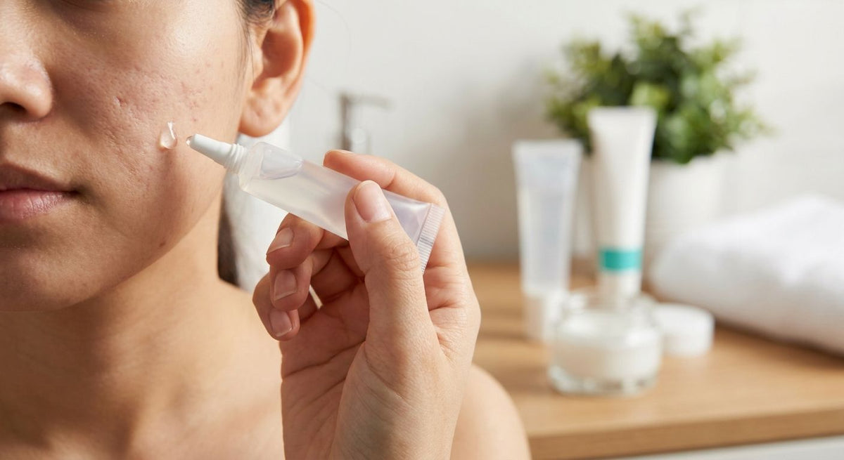 Best silicone scar gel for facial acne scarring