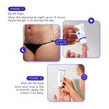 Tummy Tuck Scar Bundle