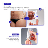 Tummy Tuck Scar Bundle